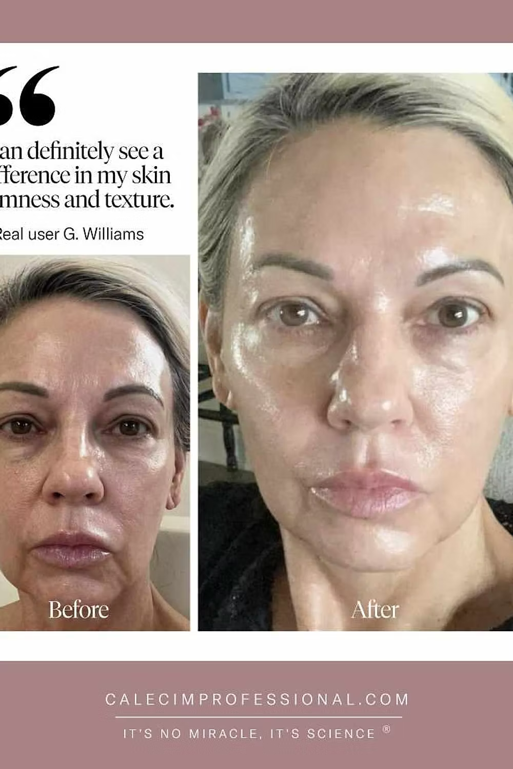 CALECIM Professional Serum 6x5ml