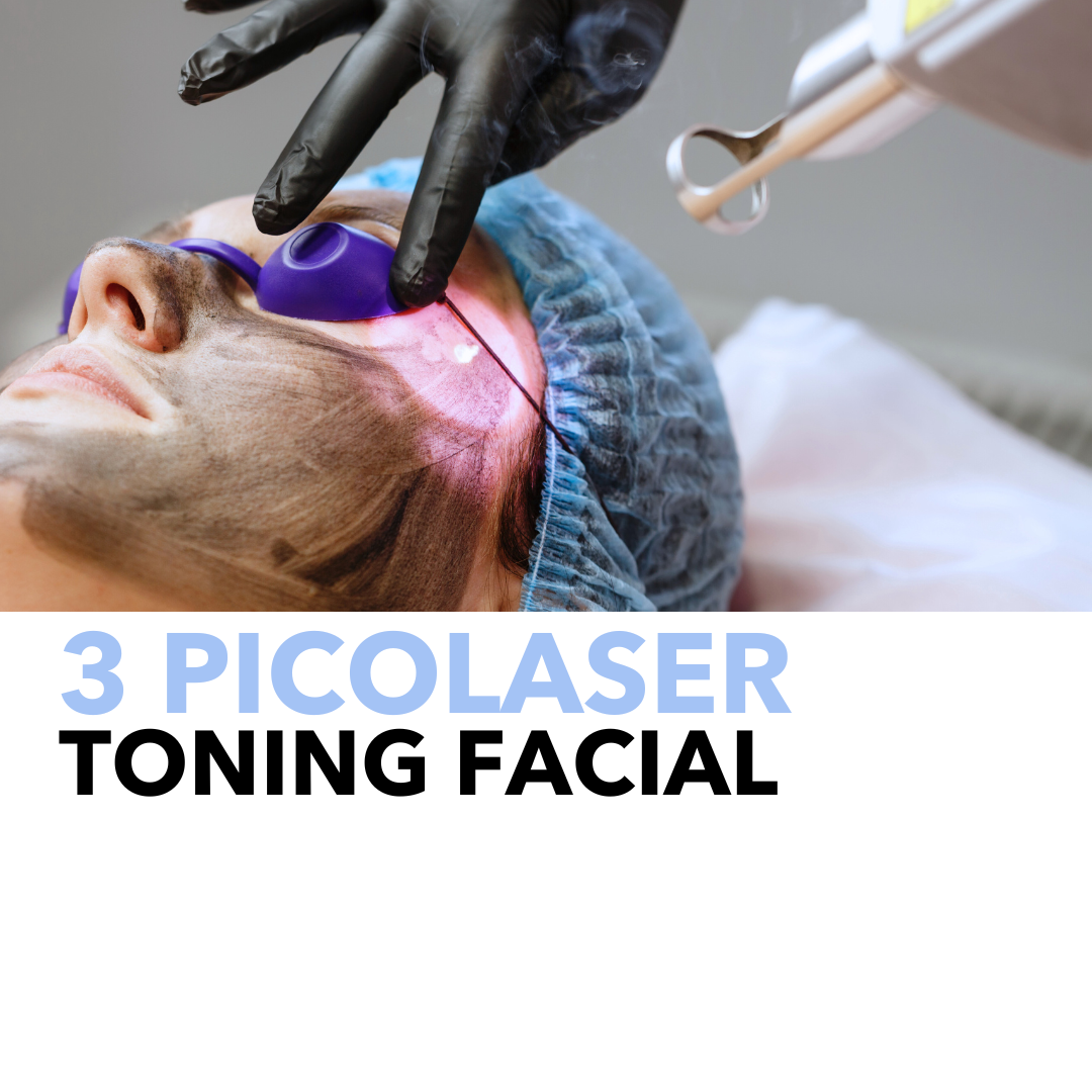 3 PACK OF PICOLASER TONING FACIAL (PIGMENTATION/MELASMA) image 0