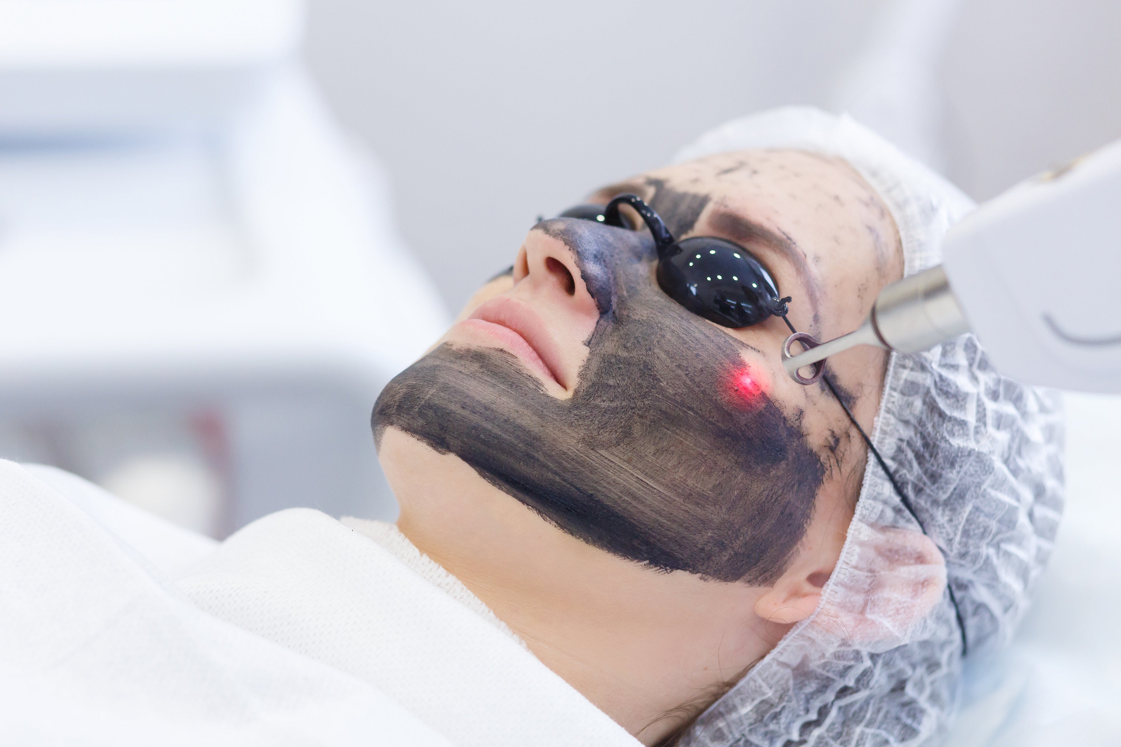 CARBON LASER FACIAL (CHINA DOLL FACIAL) image 0