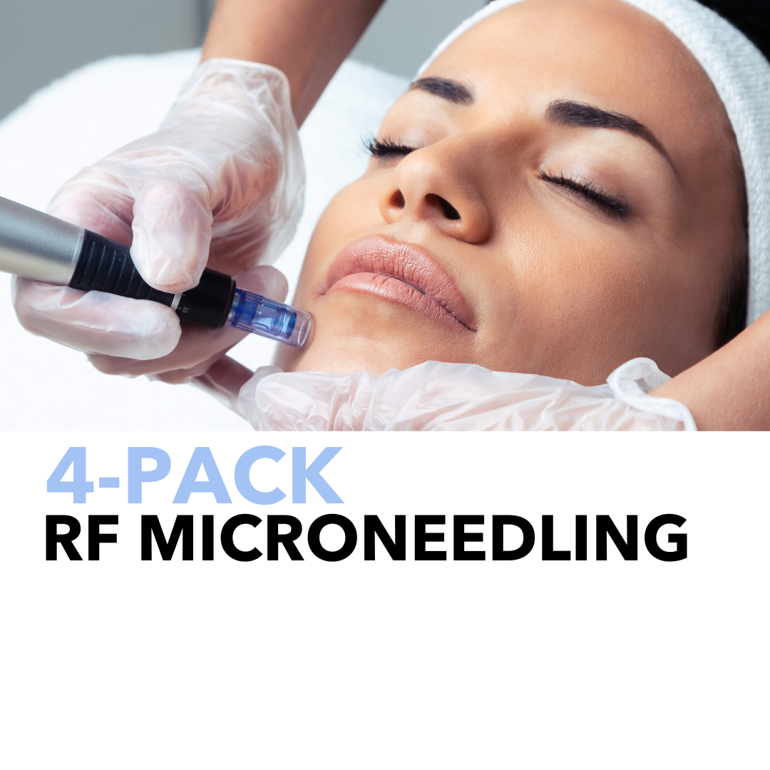 4 SESSIONS RF MICRONEEDLING image 0