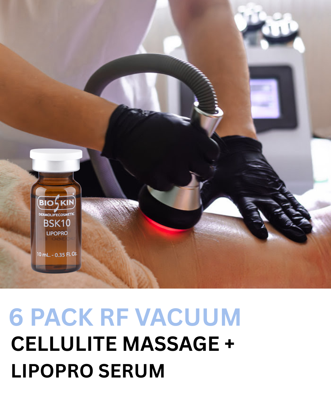 6 Pack 60min Cellulite Massage + Cellulite Ampoule + RF Vacuum