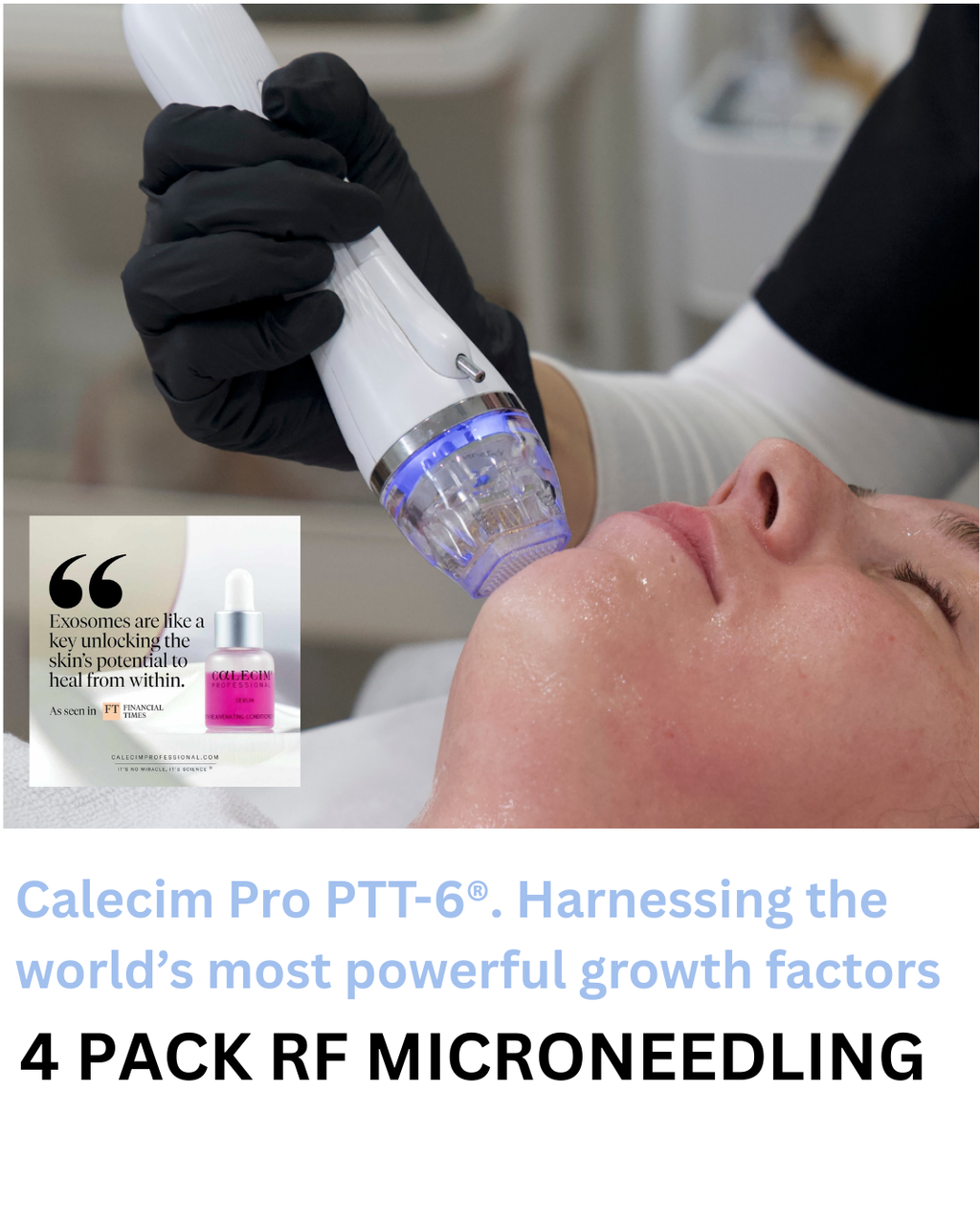 Calecim® STEM CELL RF MICRONEEDLING PACKAGE + 1 FREE AMPOULE