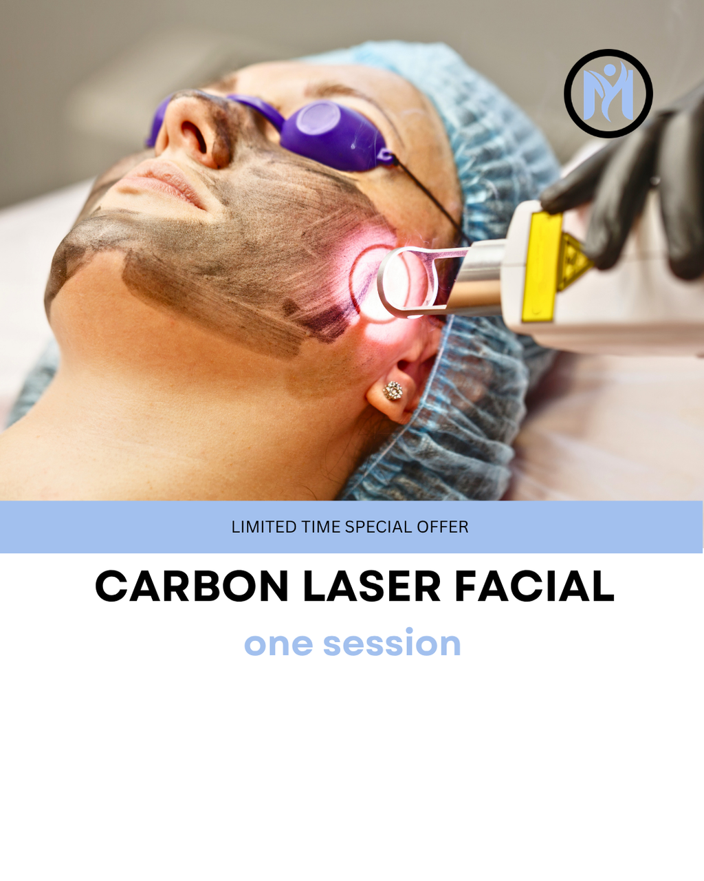 CARBON LASER FACIAL (CHINA DOLL FACIAL)