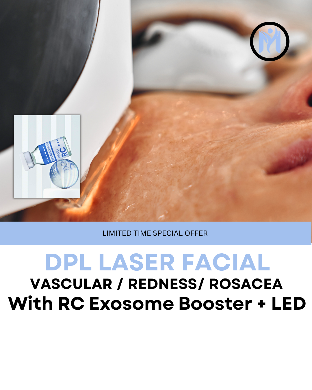DPL Vascular Laser Facial with Exosome Booster + LED – Redness and Rosacea Relief
