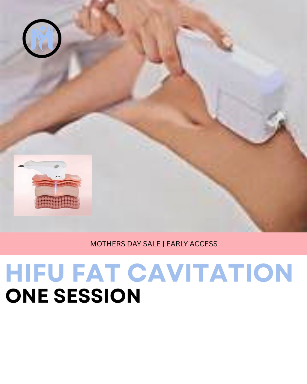 7D HIFU BODY FAT CAVITATION (ONE SESSION)
