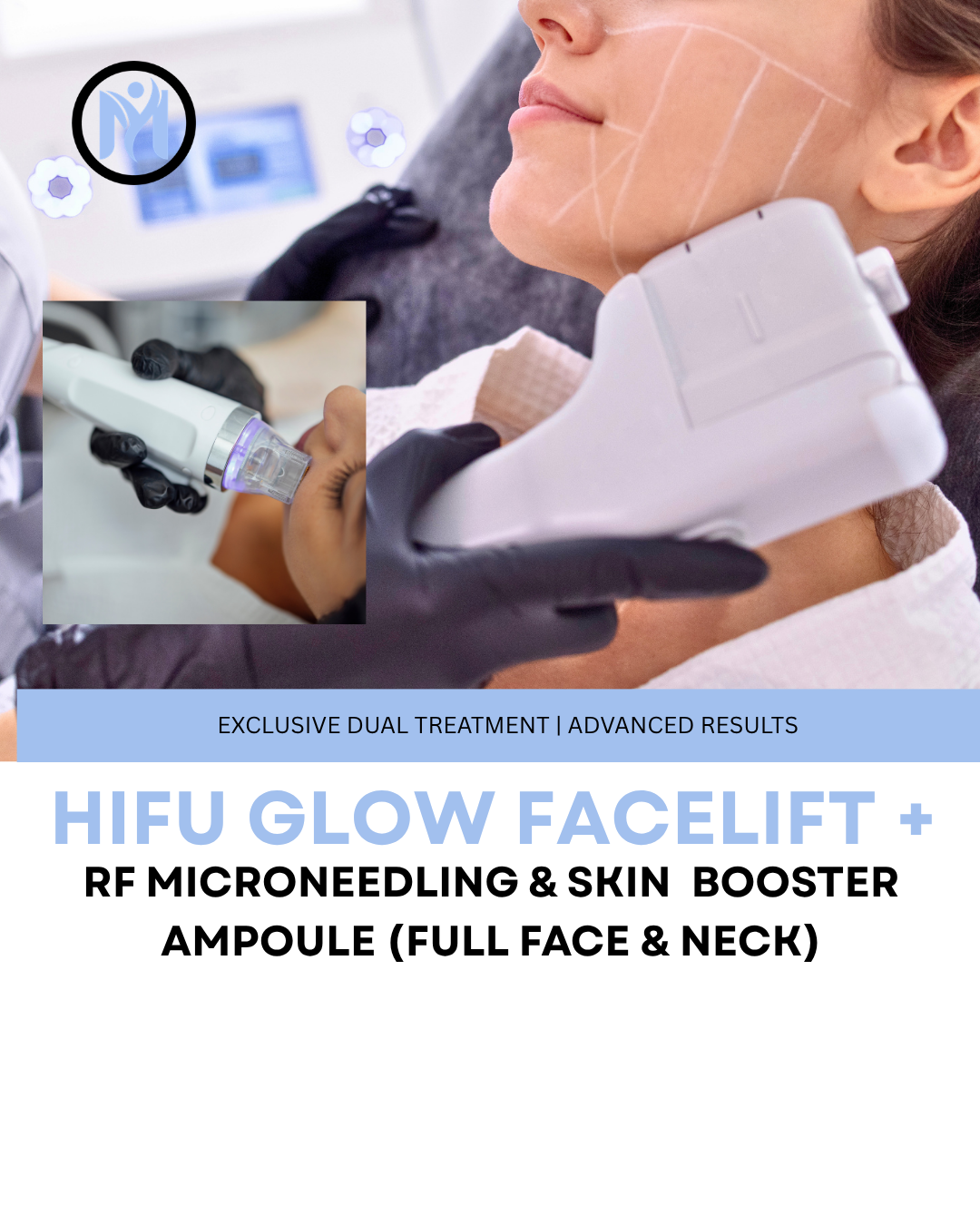HIFU GLOW FACELIFT (1.5mm) + RF MICRONEEDLING - Ultimate Lift and Glow