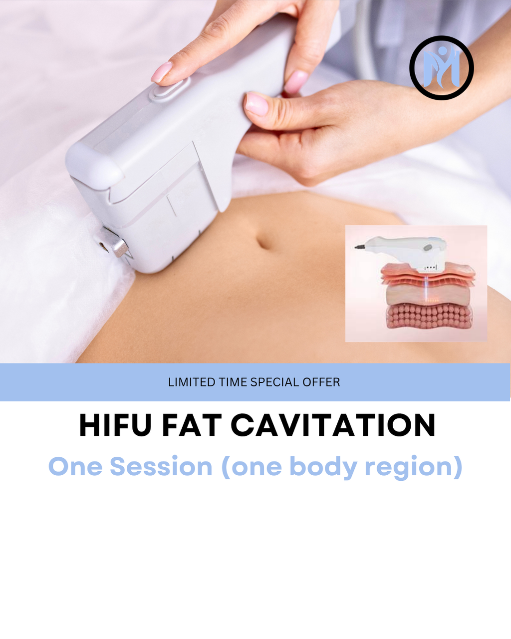 7D HIFU BODY FAT CAVITATION (ONE SESSION EOFYS 50% Off)