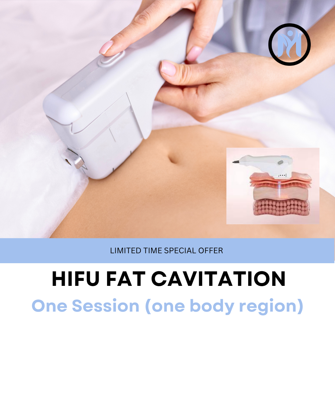 7D HIFU BODY FAT CAVITATION (ONE SESSION EOFYS 50% Off)