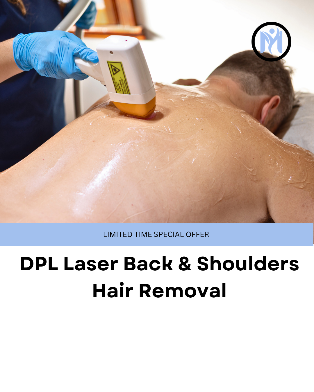 DPL Laser Back & Shoulders Hair Removal