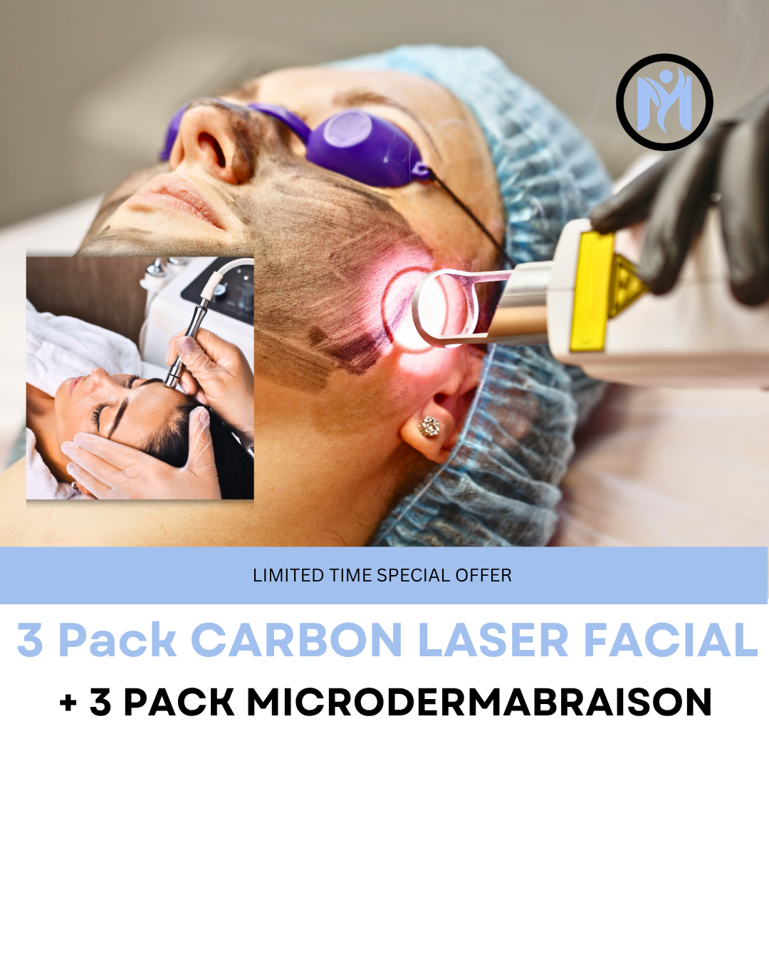 NEW PACKAGE: 3x Carbon Laser Facial + 3x Microdermabrasion Facial
