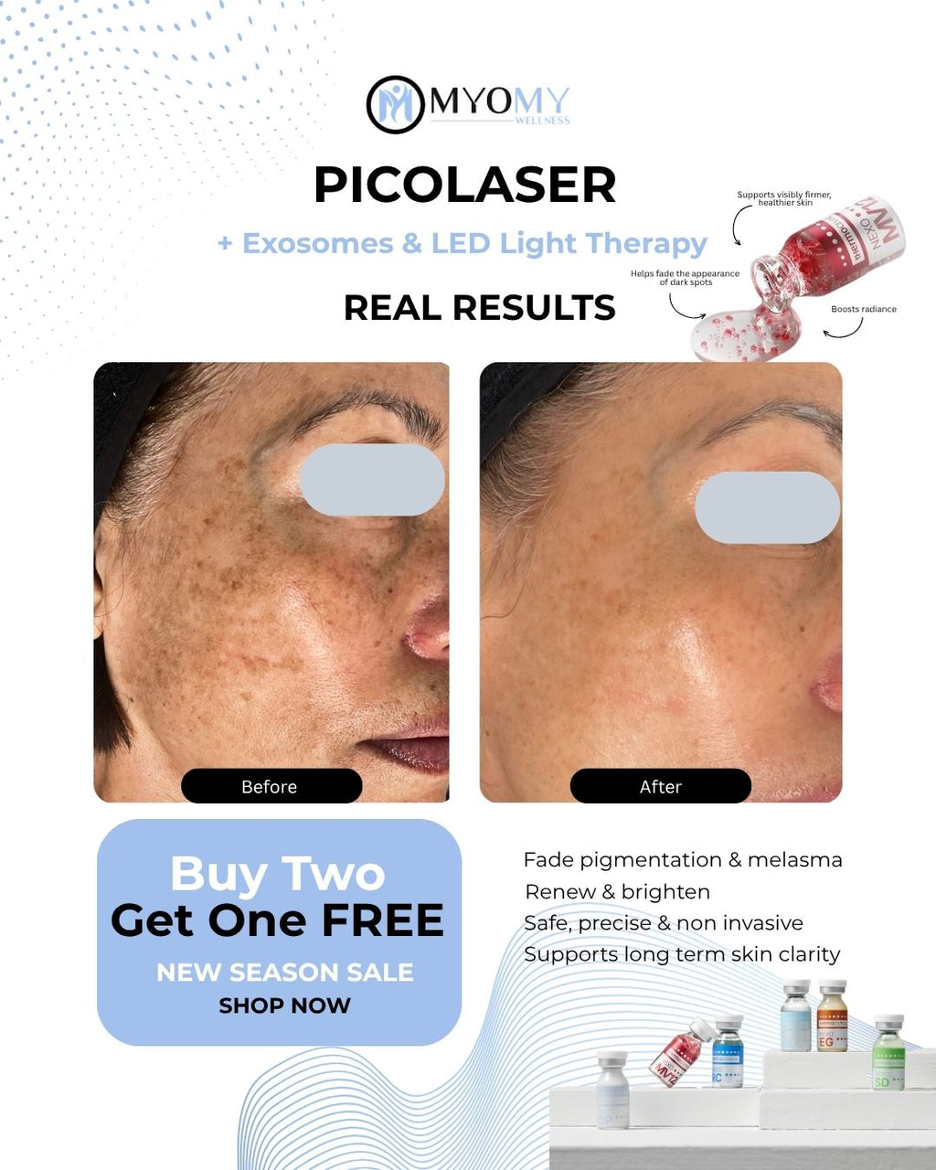 PICOLASER PIGMENTATION/MELASMA TREATMENT (One Session)