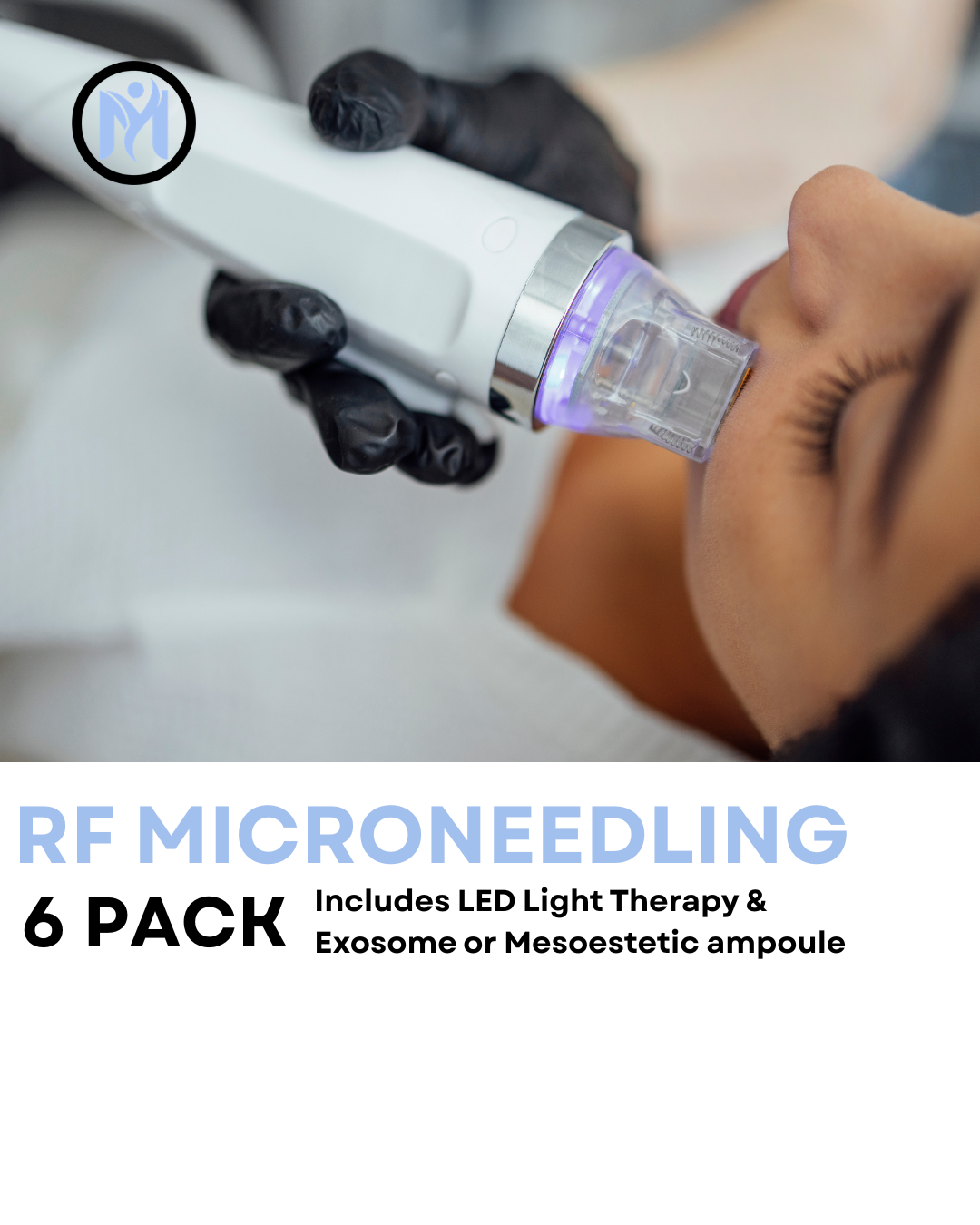 6 SESSIONS RF MICRONEEDLING FULL FACE & NECK (Includes Exosomes & LED Light Therapy)