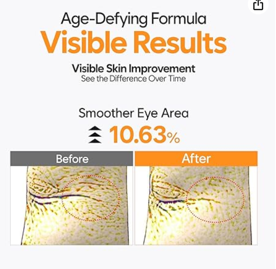 Korean Thermoceuticals EG Cream