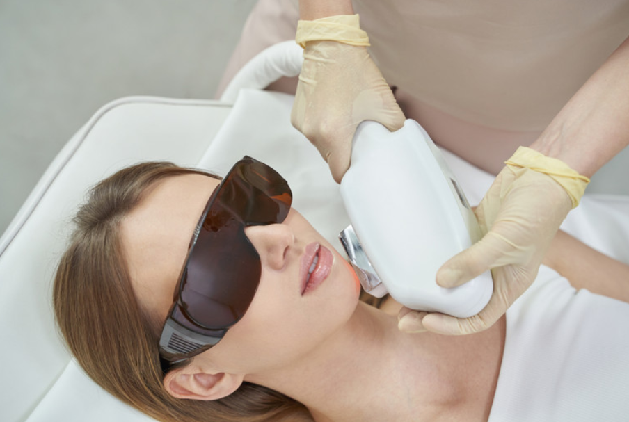 4 Pack DPL Laser Acne Treatment with LED