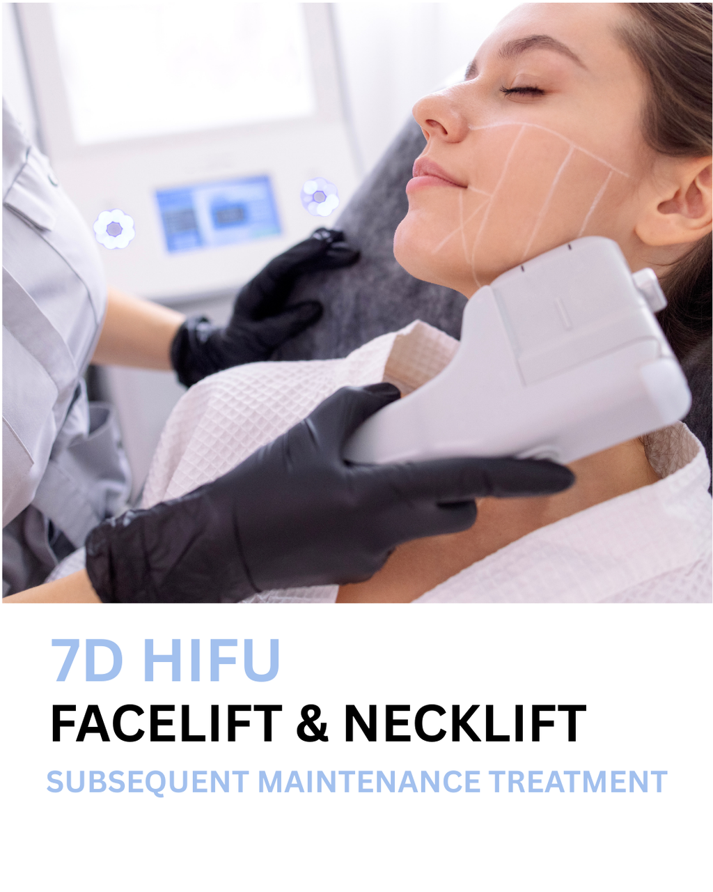 7D HIFU SUBSEQUENT FACE & NECKLIFT (MAINTENANCE) + Exosome Booster Ampoule