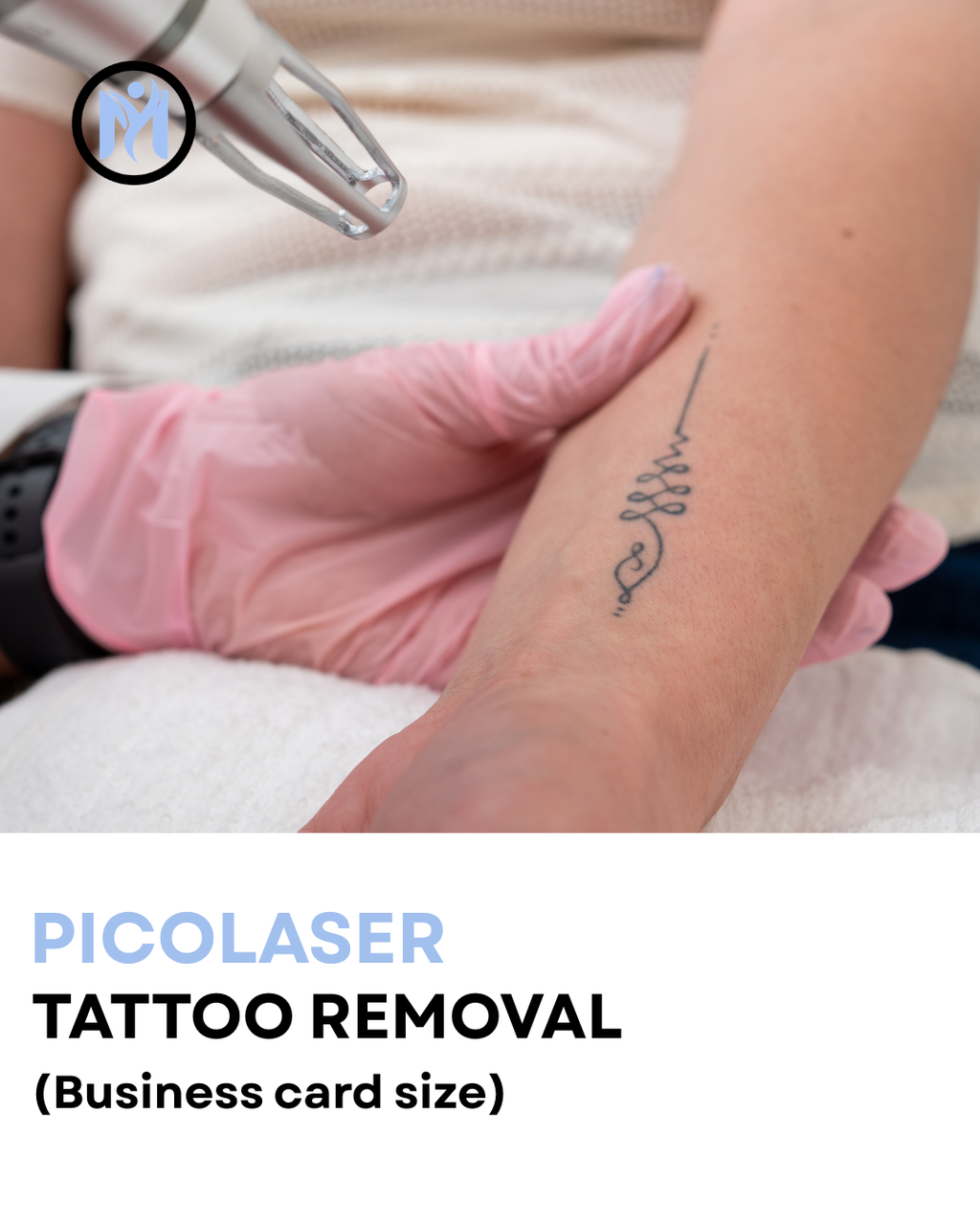 TATTOO REMOVAL BUSINESS CARD SIZE