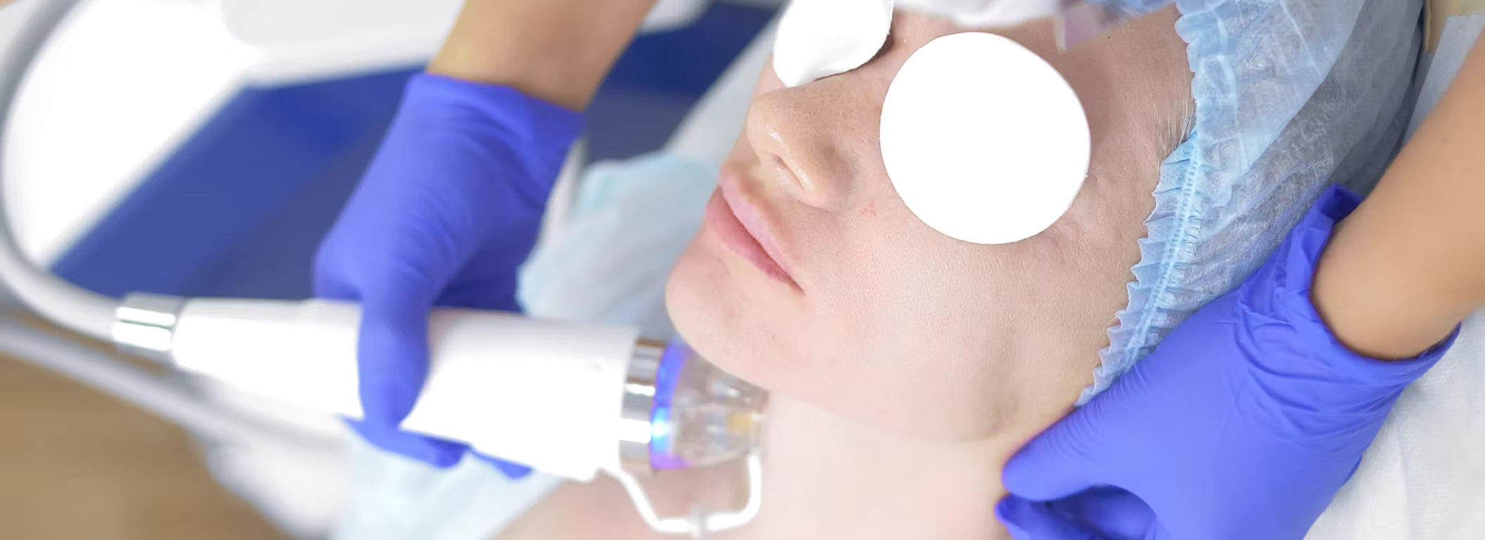 NANO NO NEEDLE MICRONEEDLING FACIAL image 0