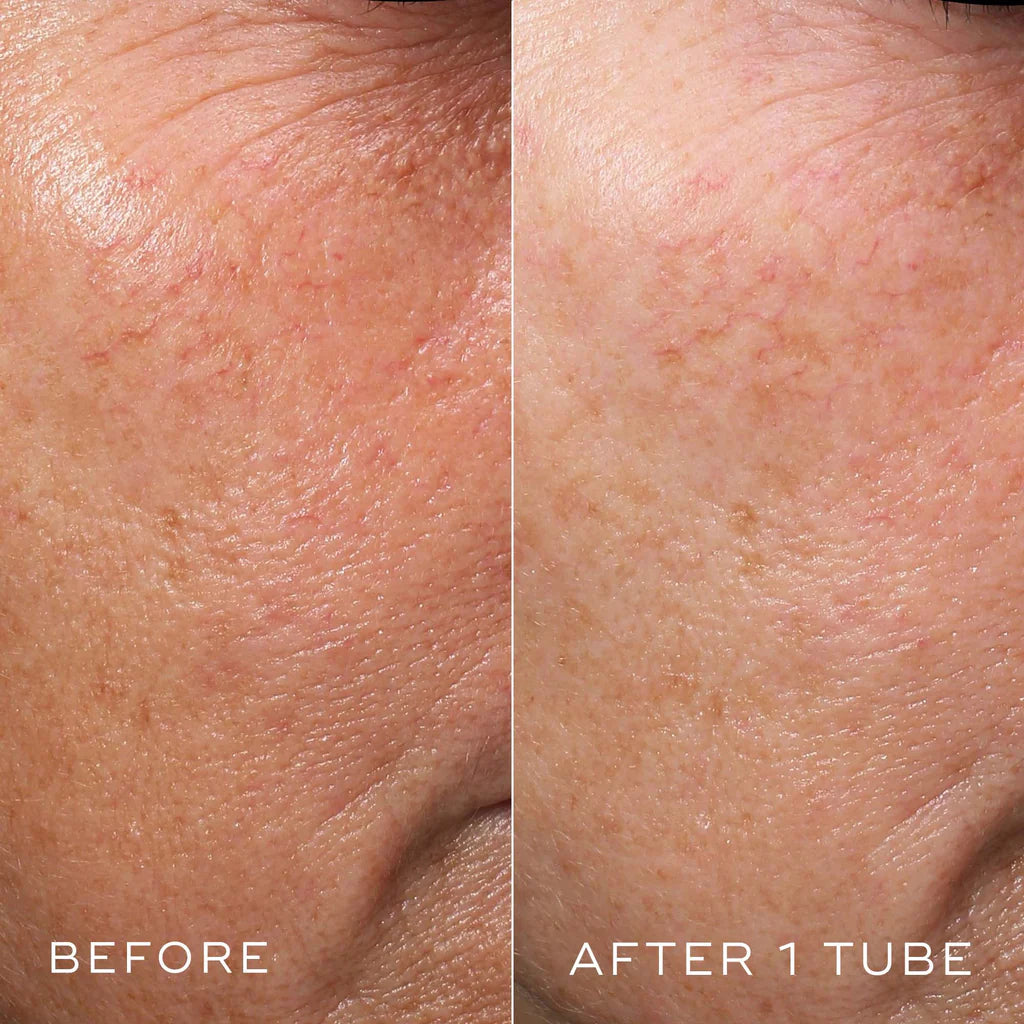 Crysral Retinal 3 image 4