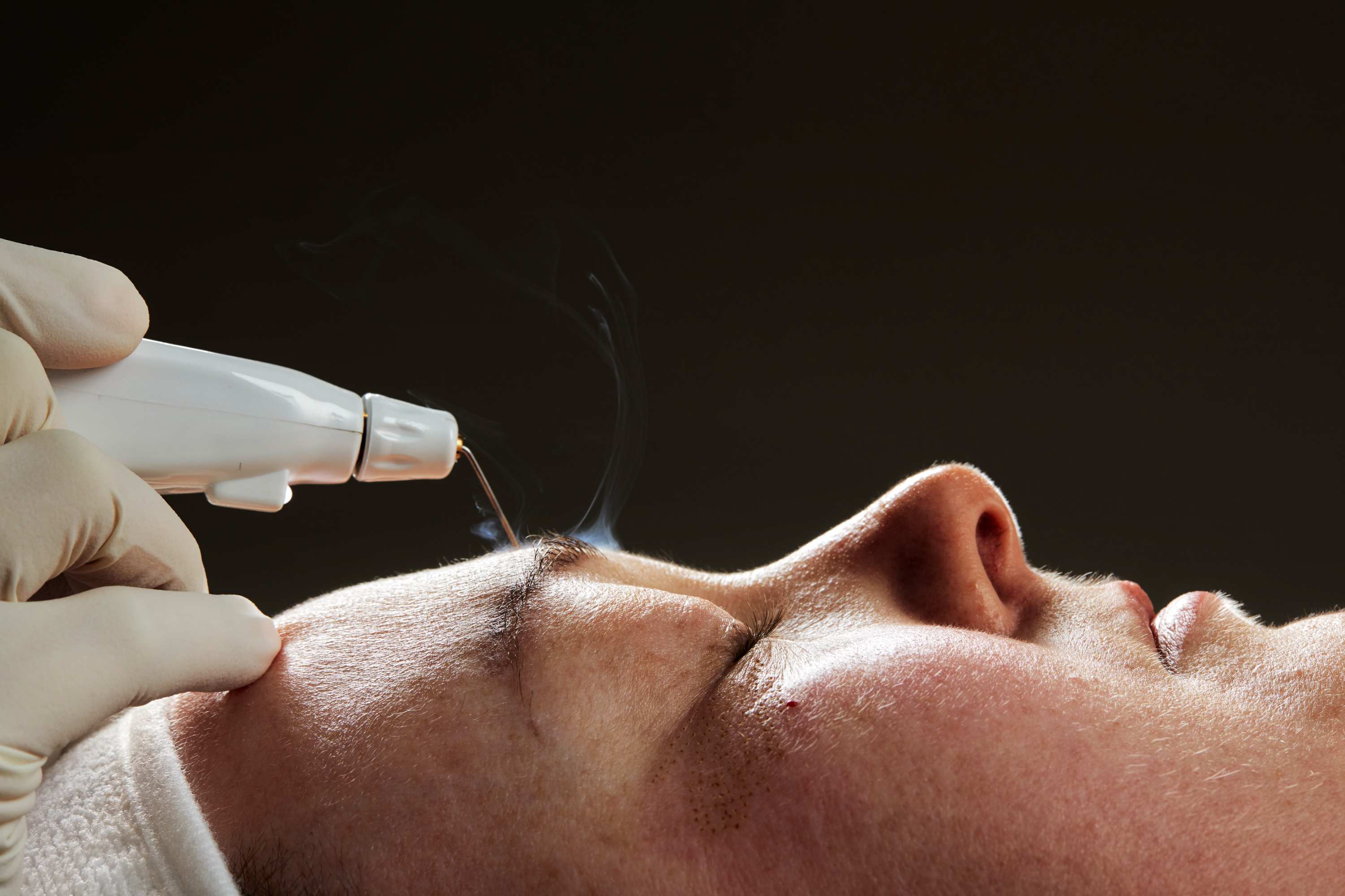 Plexr Fibroblast Ocular 11 Lines image 0