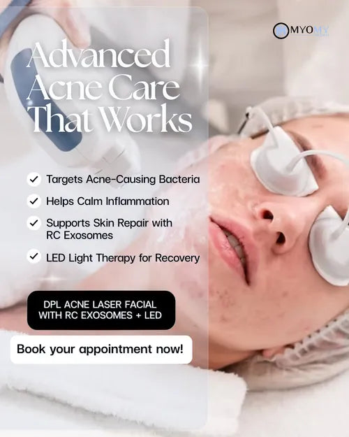 DPL Laser Acne  Facial Treatment